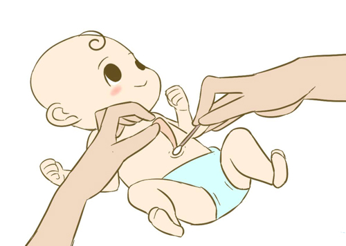 新生兒臍帶護理